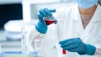 covid laboratoř -19-5169689 1280